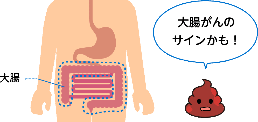 大腸と血のついた便のイラスト