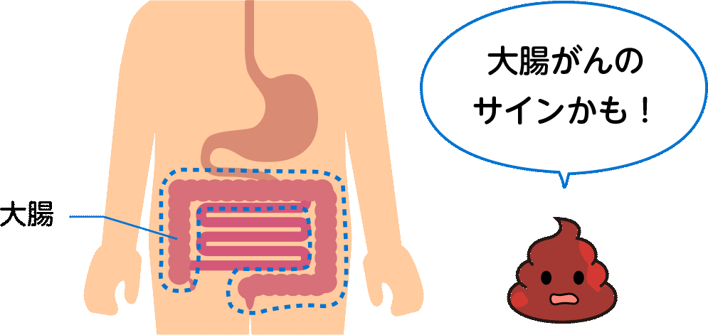 お役立ち 便秘解消クイズ べんぴ編 おなかのはなし Com